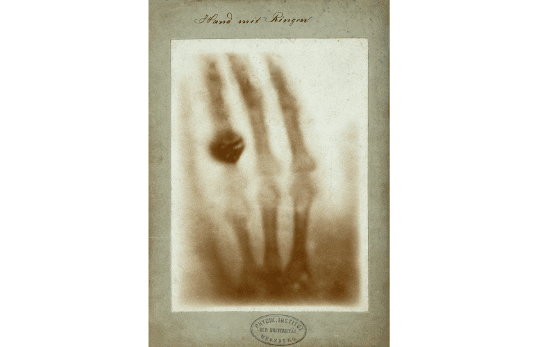 Radiographie de la main d'Anna Bertha Röntgen — Wilhelm Röntgen — 1895
